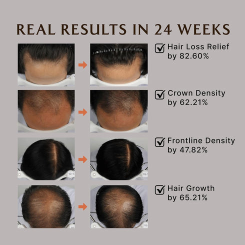 LA'DOR Dermatical Nourishing Hair Mask Treatment, Hydrating Deep Conditioner for Dry Thinning Hair, Korean Haircare