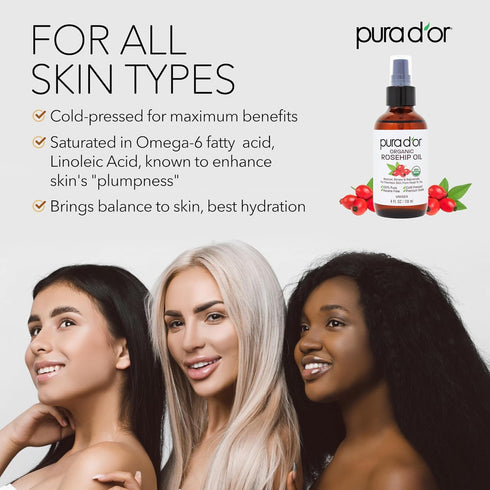 PURA D'OR 4 Oz Organic Rosehip Seed Oil Hair Relaxer, 100% Pure Cold Pressed