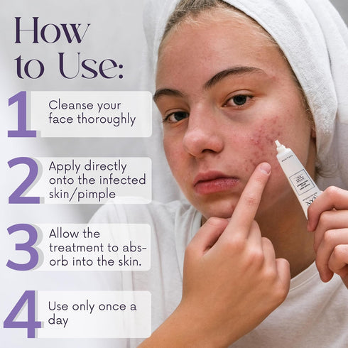 NXN Acne Edit Spot Treatment with Probiotics, Licorice Root, Ginger, and Colloidal Sulfur for Rapid Acne Reduction