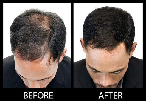Volumizing Hair Fibers with Real Keratin for Thinning Hair, 60 Days+ Supply, Dermatologist Tested, Black