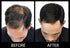 Volumizing Hair Fibers with Real Keratin for Thinning Hair, 60 Days+ Supply, Dermatologist Tested, Black