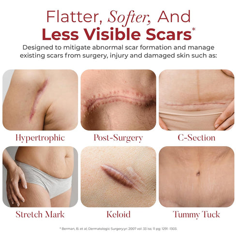 HealFast Physician Formulated Silicone Scar Sheets - Advanced Crosspolymer Medical Grade Silicone Scar Tape