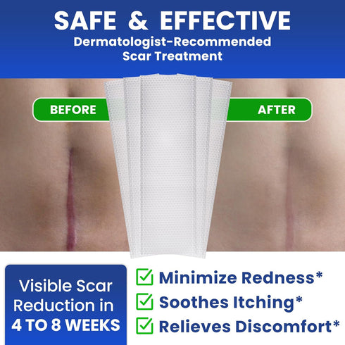 AWD Silicone Scar Sheets for Scar Removal, Extra Thick 0.5mm Silicone Scar Tape for Surgical Scars, C Section, Keloid