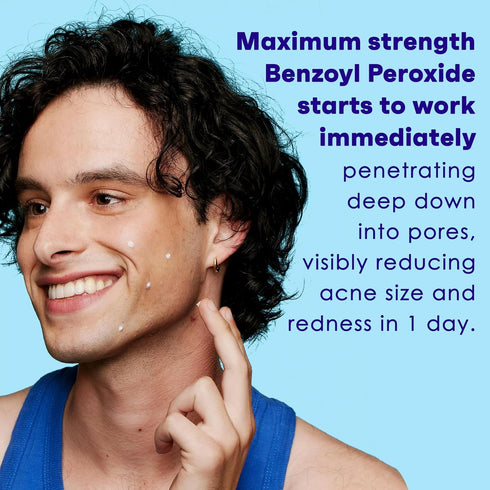 up & up 1 oz Maximum Strength Acne Medication