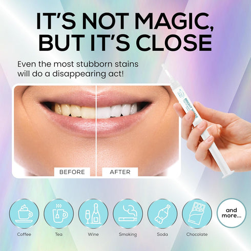 Venus Visage Teeth Whitening Gel Refill Kit, 8 Pack Syringes, 35% Carbamide Peroxide, No Sensitivity for Dazzling Smile