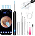 Ear Wax Removal Kit with Camera - 1269P HD Otoscope, Ear Cleaning Kit with Lights and 6 Ear Picks for All Ages