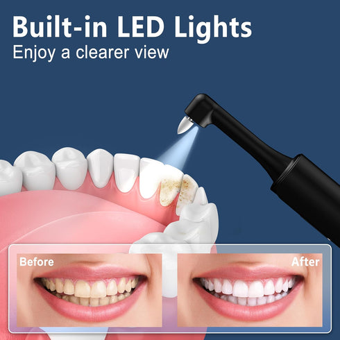 Tooth Polisher Electric Dental Cleaning Kit, Rechargeable with 5 Brush Heads, 4 Speed Modes, LED Light, IPX6 Waterproof