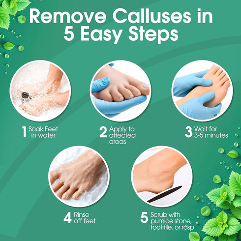 Pack, 4 DeEnti Callus Maintenance Bundle Includes Mint Scented Callus Remover, Metal Foot Rasp, Foot File, and Pairs