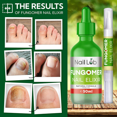 Nail Lab 50 ml 3 ml Premium Fu Nail Elixir for Toenails - | Includes Pen & File | Extra Strong Nail Care Strengthener |