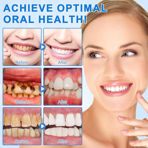 PULLING OIL 9.9% Hydroxyapatite Toothpaste, Nano Hydroxyapatite Toothpaste Protects Enamel and Strengthens Teeth