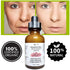 Resveratrol Skin Serum, Antioxidant Anti-Aging Factor for Fine Lines, Wrinkles & Skin Elasticity