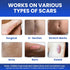AWD Silicone Scar Sheets for Scar Removal, Extra Thick 0.5mm Silicone Scar Tape for Surgical Scars, C Section, Keloid