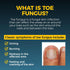 Fungi-Nail Anti-Fungal Liquid Solution, 1 Fl Oz, Kills Fungus for Nail & Athlete's Foot, Clinically Proven Cure