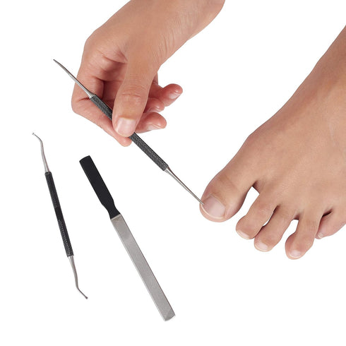 KLIPP Ingrown Toenail Tool Kit for Men and Women – Ingrowing Toe Nail Lifter, Rounded File, Metal Fingernail File for
