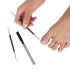 KLIPP Ingrown Toenail Tool Kit for Men and Women – Ingrowing Toe Nail Lifter, Rounded File, Metal Fingernail File for