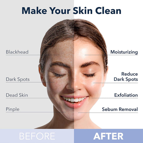 Purederm Deep Purifying Pink O2 Bubble Mask, 5 Pack - Bubble Face Sheet Mask for Purifying & Moisturizing