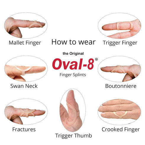 Oval-8 Finger Splints, Support for Arthritis, Trigger Finger, Size 3 (Pack of 1)