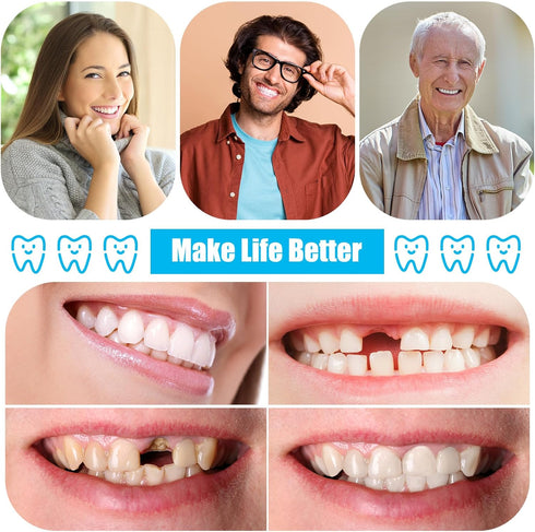 TrelaCo 16 Pcs DIY Dentures Repair Kit - Make Your Own Dentures, Repair Missing Teeth, Customizable Solution for Smile
