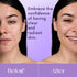 NXN Acne Edit Spot Treatment with Probiotics, Licorice Root, Ginger, and Colloidal Sulfur for Rapid Acne Reduction