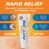 PHYTOZINE 1% 15+ 1 oz Anti Fungal Cream for Skin with Tolnaftate - Ringworm Treatment for Humans - Effective Athletes