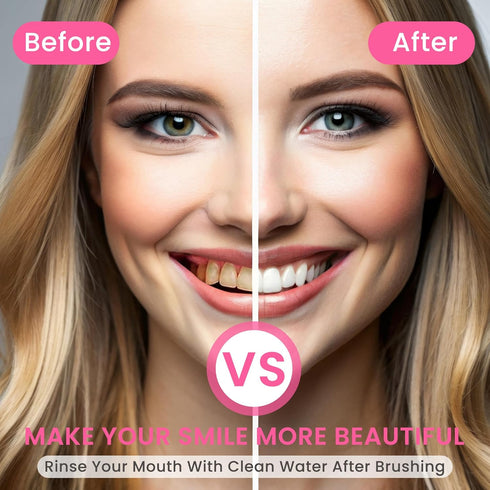 Niacinamide Whitening Toothpaste, BodyAccel Natural Toothpaste for Stain Removal and Fresh Breath (1)
