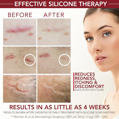 HealFast Silicone Scar Gel & Cream for Surgical Scars - Medical Grade Scar Treatment & Removal for Keloid, Acne, Burns