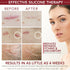 HealFast Silicone Scar Gel & Cream for Surgical Scars - Medical Grade Scar Treatment & Removal for Keloid, Acne, Burns