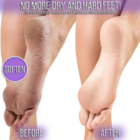 SOO Jelly Pedicure Packs - Moisturizing Foot Soak for Feet, Jelly Spa Pedi Soak, Foot Gel for Soaking - Lavender