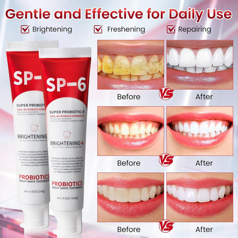 SP-6 SP-6 6 4.9oz, 2Pack Probiotic Whitening Toothpaste, Probiotic Toothpaste, Enhanced Formula with Probiotics