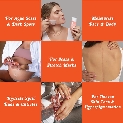 Bio-Oil Dry Skin Travel Skincare Bundle - 1.7 Oz Oil & 2 Oz Gel for Hydration