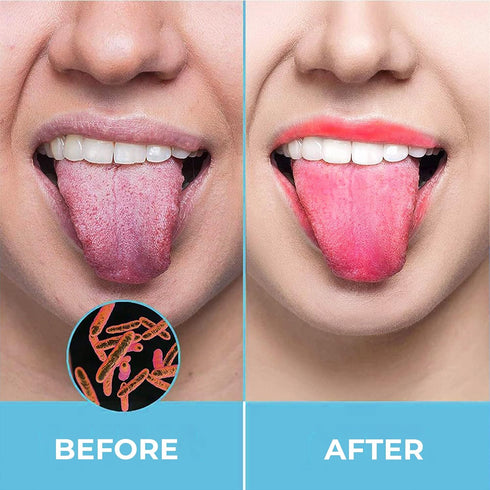 HOKIN Tongue Scraper for Adults, 2Pcs Oral Care Pack, Stainless Steel Cleaners, Reduce Bad Breath