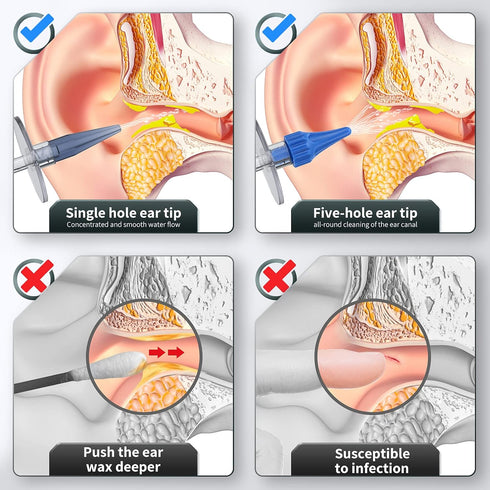 Ear Wax Removal Kit, Manual Ear Irrigation Flushing System for Safe and Effective Ear Cleaning