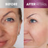 Retinol Gold Peel-Off Mask - Tightens, Lifts, Soothes & Hydrates Skin - Real Gold & Flower Extracts Nourish