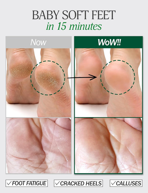 Moisturizing Foot Mask for Dry Cracked Feet - Hydrating Foot Spa Kit, Baby Feet Foot Peel, Cracked Heel Repair with