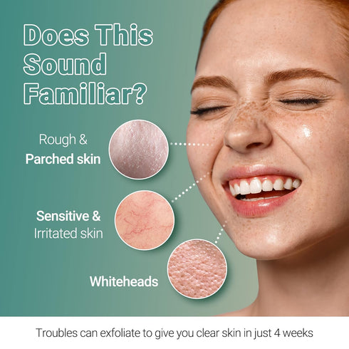 Clear Whitehead Remover Peel Off Face Mask 5pcs - Hydrating Beauty Sheets for Skin Care