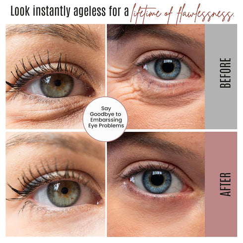 Instant Eyelift Cream, Anti Aging Serum for Dark Circles, Puffy Eyes, & Wrinkles - 12