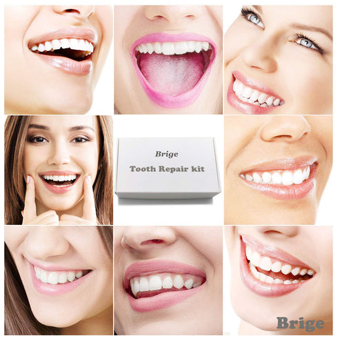 Tooth Repair Kit for Fixing Missing, Chipped, and Broken Tooth Gap with Thermal Beads and Fake Teeth Brace Mold