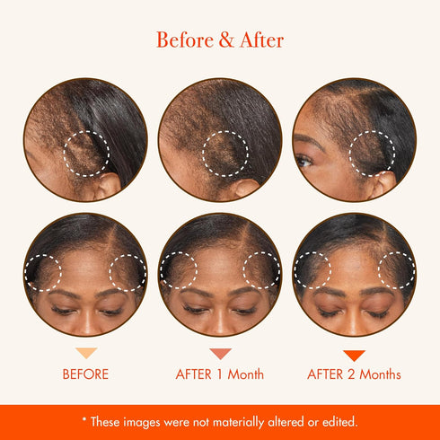 RED by Kiss Hair Growth Scalp Ampoule - Growth MD Scalp Strengthening with 10X Biotin and Rosemary Oil