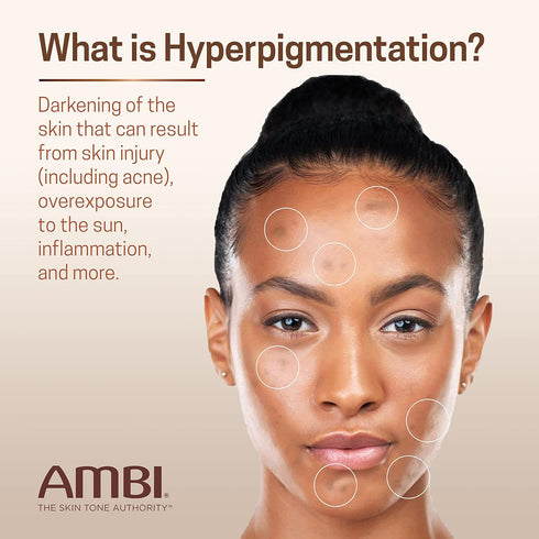 Ambi Even & Clear Fade Cream, Hydroquinone-free, Hyperpigmentation Treatment, Dark Spot Corrector, 1 Fl Oz