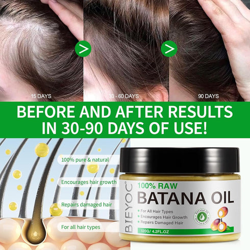 Raw Batana Oil for Hair Growth, 100% Pure from Honduras, Prevents Hair Loss, Repairs Damage, 4.2 oz