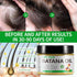 Raw Batana Oil for Hair Growth, 100% Pure from Honduras, Prevents Hair Loss, Repairs Damage, 4.2 oz
