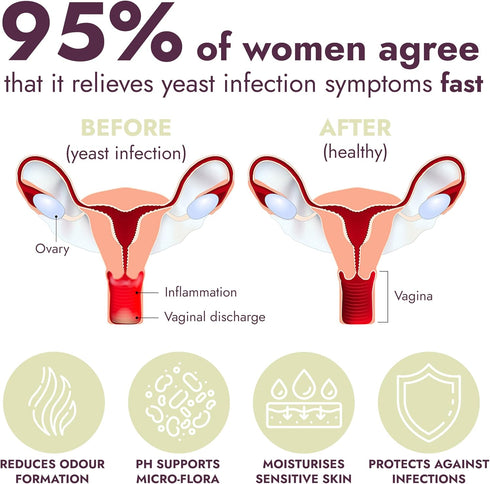 Inflammation, 7 Count Terramed Just Think Comfort Yeast Infection Treatment for Women | Ph Balance for Women | Helps