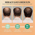 WEEMOTD 100% 2 oz Batana Oil for Hair Growth Dr Sebi, Raw Organic Batana Hair Mask from Honduras, Wild Growth Hair Oil
