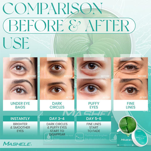 Korean 60pcs Aloe Vera Collagen Under Eye Gel Patches Mask, Treatment for Puffy Eyes, Dark Circles - 60pcs