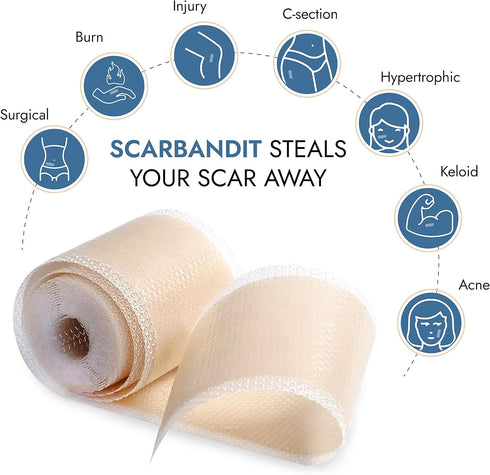 Scarbandit Silicone Scar Sheets - Treatment for Keloid, Tummy Tuck, Burns, Hypertrophic & Surgical Scars