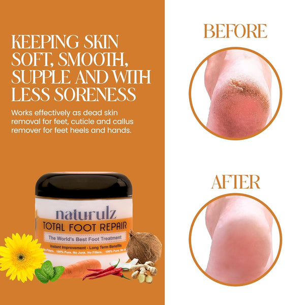 Naturulz Total Foot Repair 4oz, No Junk Foot Cream for Dry Skin & Cracked Heels, Lightweight Moisturizer