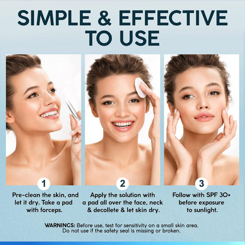 NUVADERMIS 35% Glycolic Acid Exfoliating Facial Peel Pads for Sensitive Skin - 60 Double-Side Pads, Blackheads & Acne