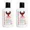 Kitikiti Scalp & Skin Treatment, Non/Oily, 4 oz. (Pack of 2)