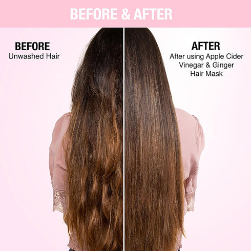 Nykaa Naturals Hair Mask, Apple Cider Vinegar and Ginger, 6.76 oz - Anti-Dandruff Hair Care for Women - Promotes Hair Growth - Safe on Colored Hair