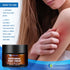 Ingredients-50g Athletes Foot Treatment-Antifungal Cream-Treatment for Jock Itch,Ringworm, Psoriasis,Eczema,Rash-Anti